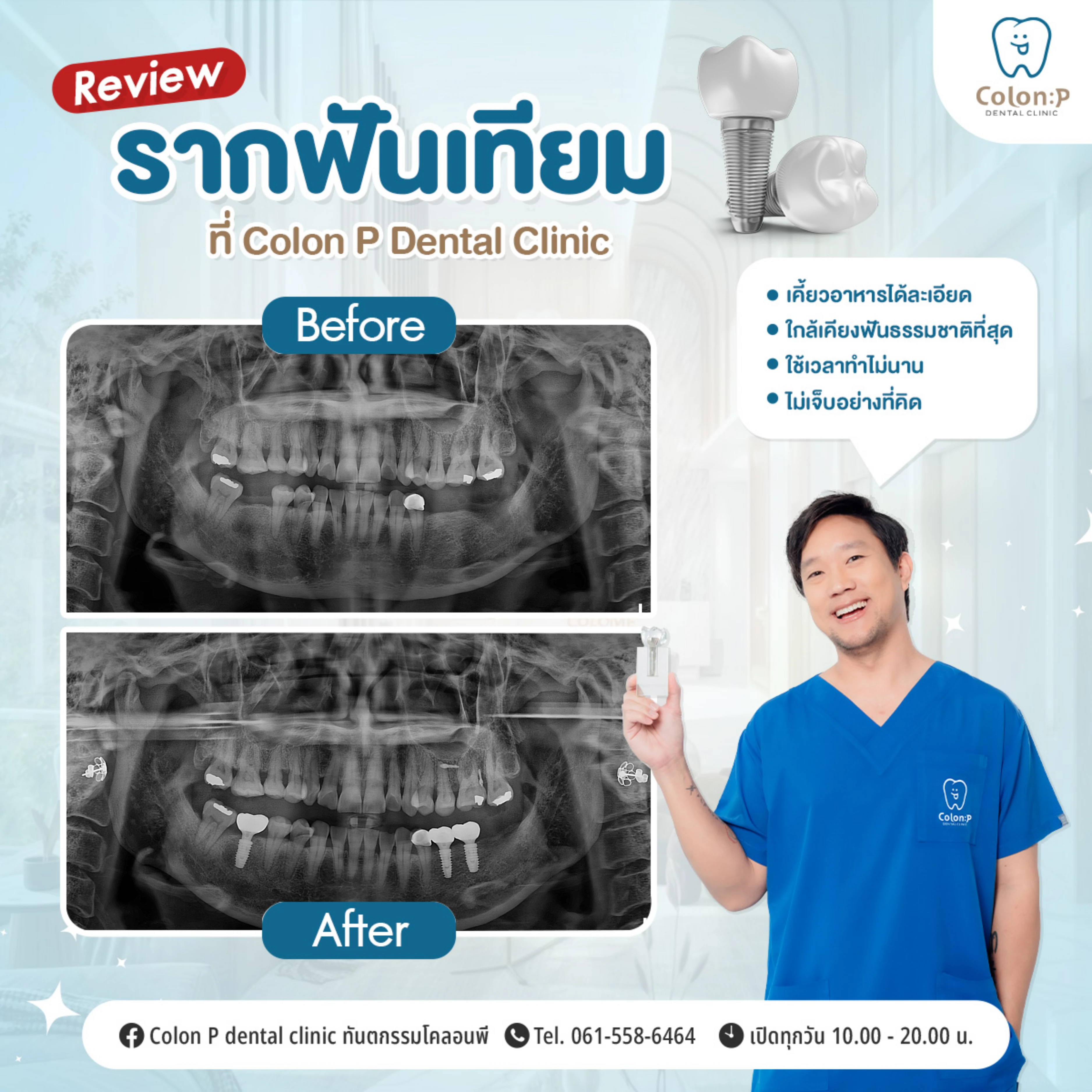 Colon P โคลอนพี คลินิกทำฟันโคราช ทันตกรรมครบวงจร จัดฟันใส invisalign ...
