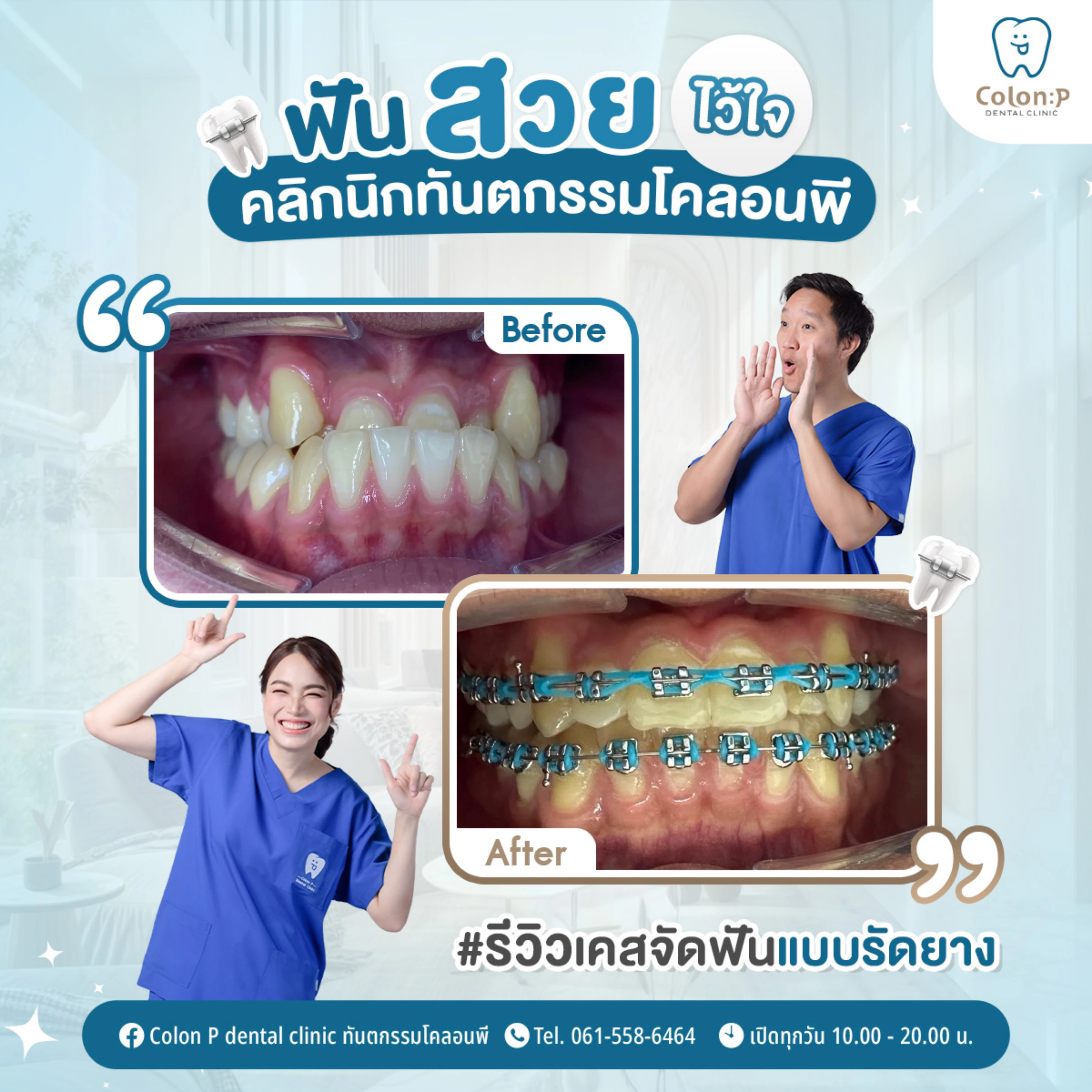 Colon P โคลอนพี คลินิกทำฟันโคราช ทันตกรรมครบวงจร จัดฟันใส invisalign ...