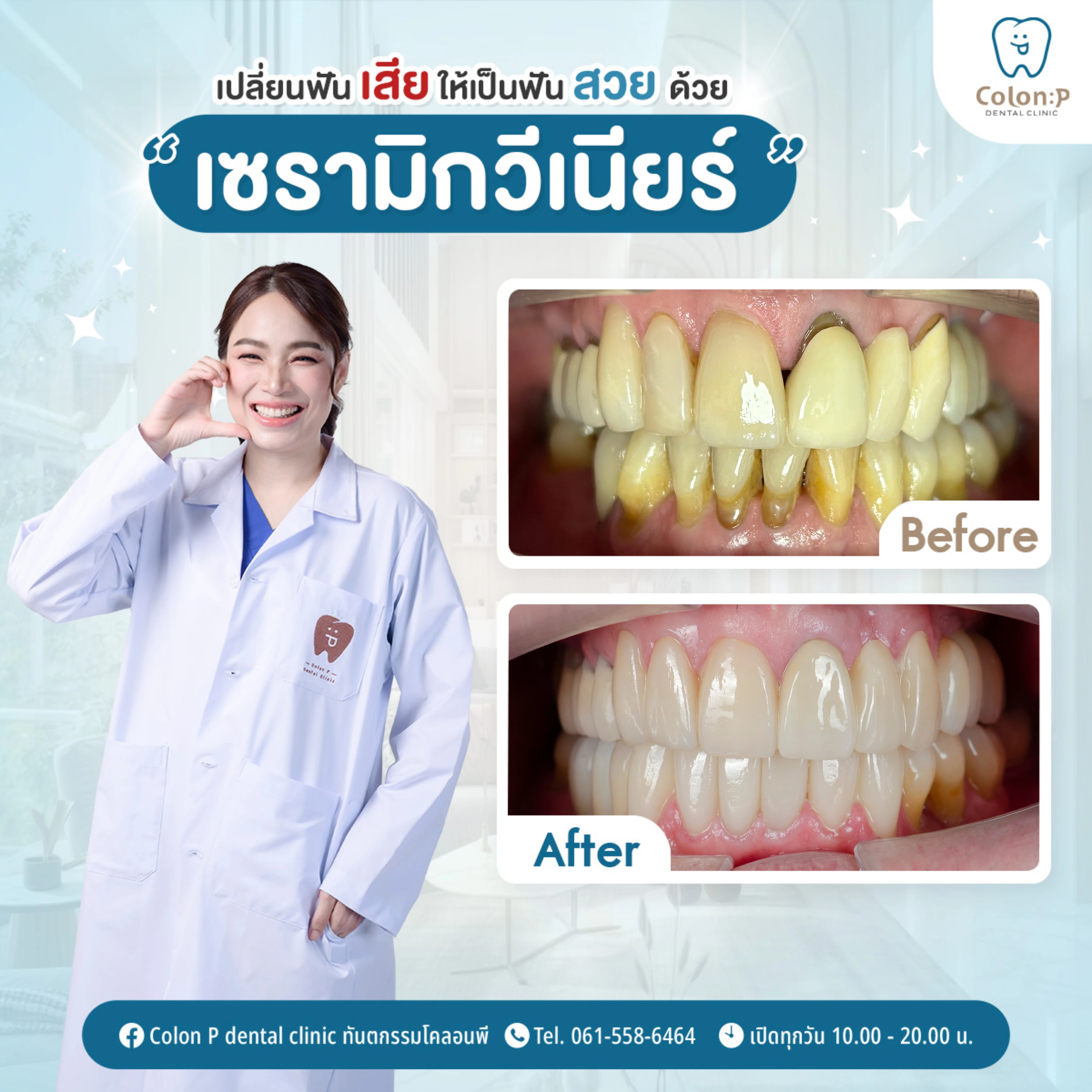 Colon P โคลอนพี คลินิกทำฟันโคราช ทันตกรรมครบวงจร จัดฟันใส invisalign ...