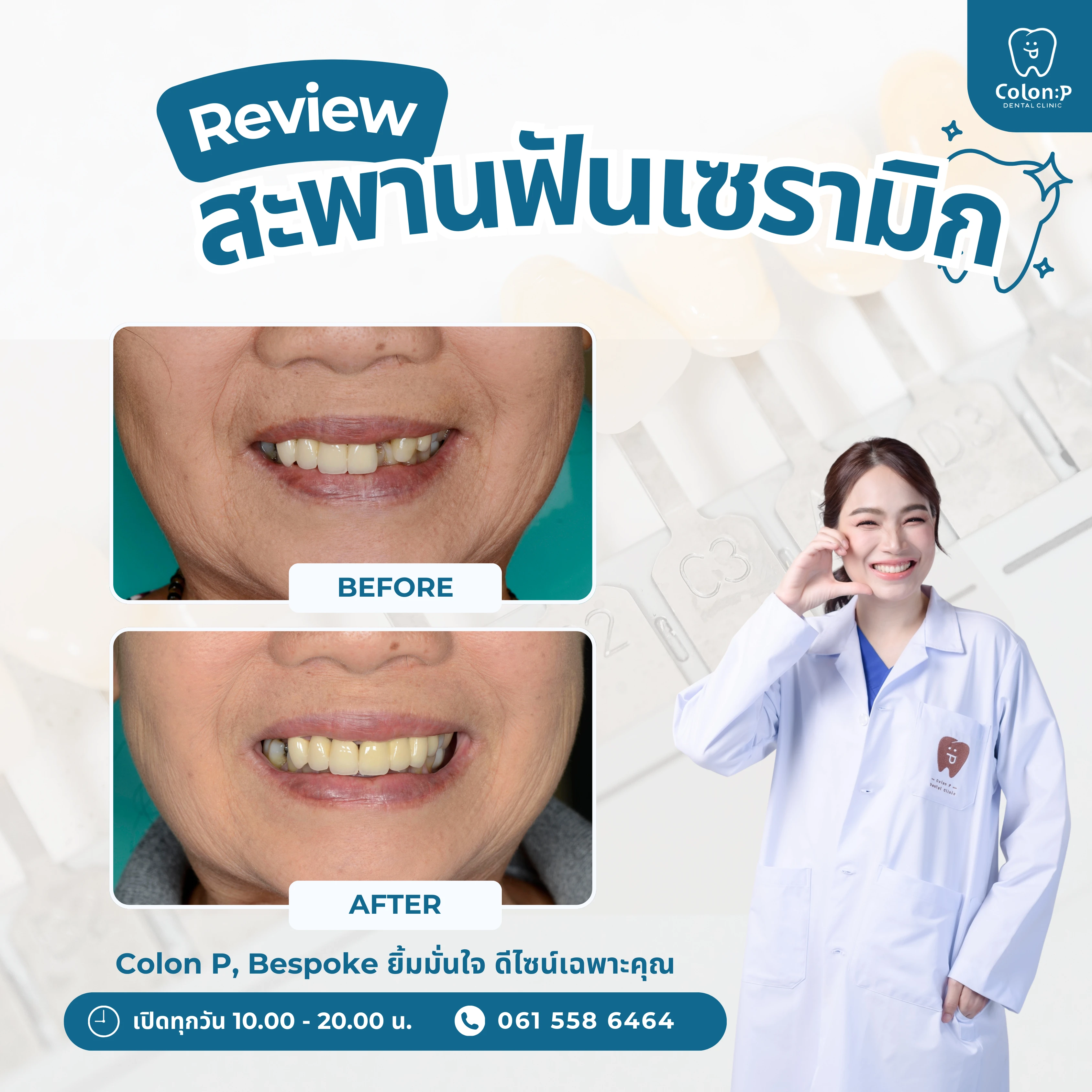 Colon P โคลอนพี คลินิกทำฟันโคราช ทันตกรรมครบวงจร จัดฟันใส invisalign ...